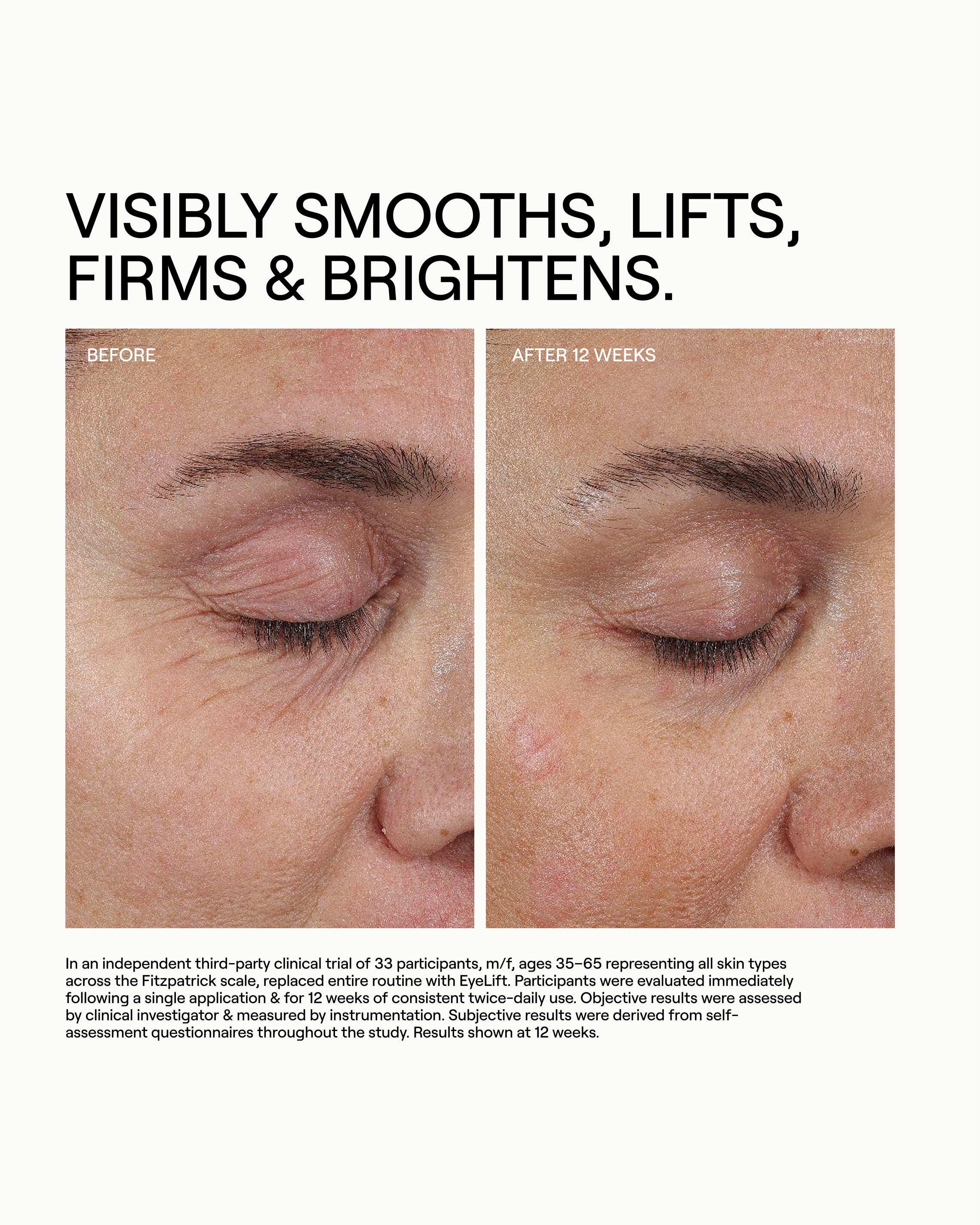 EyeLift Bioremodeling Peptide Multiplex Eye Serum – Dr. Diamond's