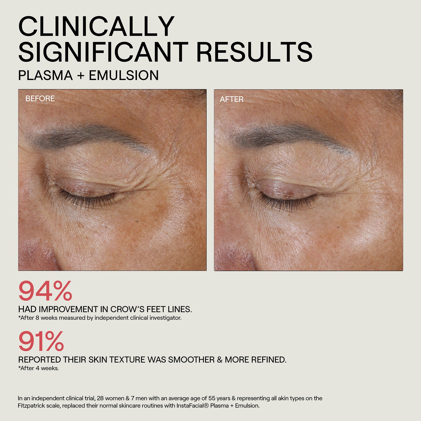 INSTAFACIAL® PLASMA