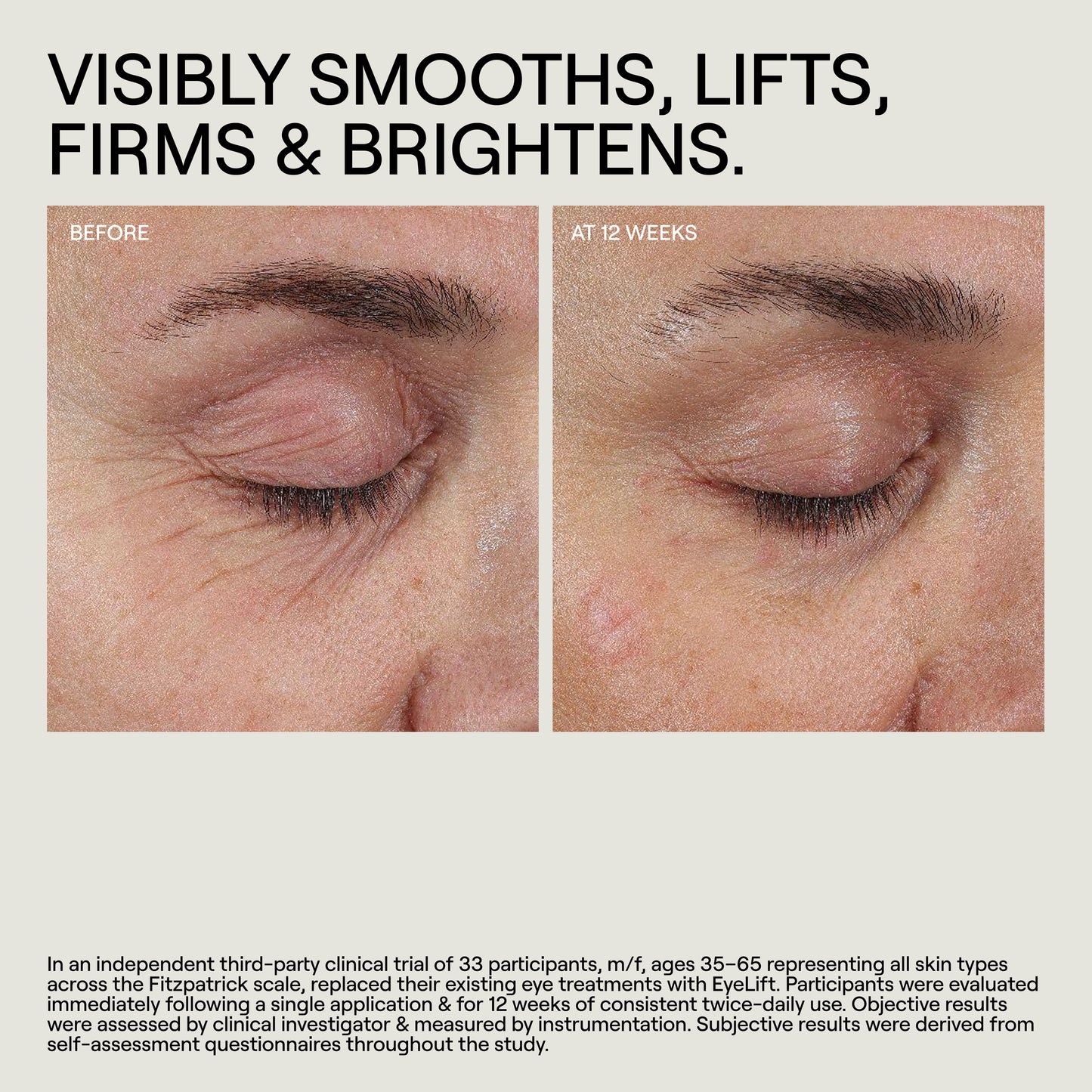 EyeLift